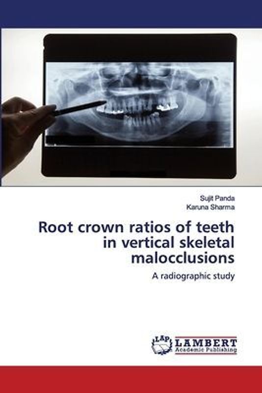 Root crown ratios of teeth in vertical skeletal malocclusions