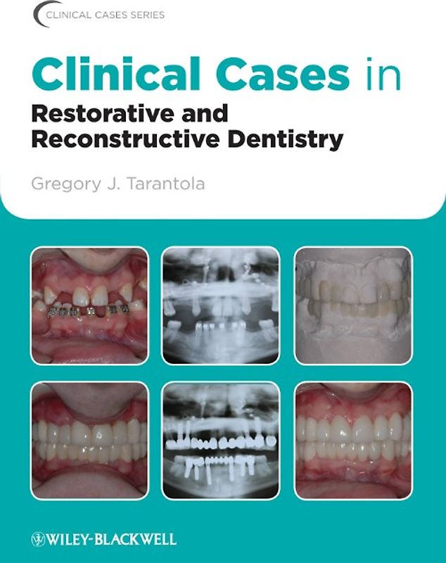 Clinical Cases in Restorative and Reconstructive Dentistry