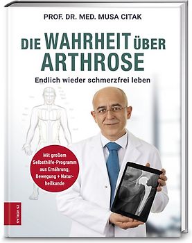 Die Wahrheit über Arthrose