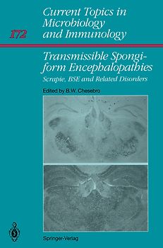 Transmissible Spongiform Encephalopathies: