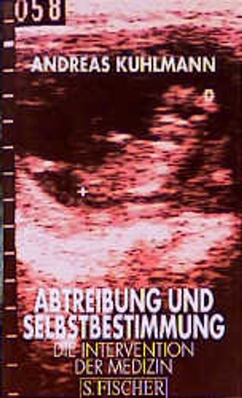 Abtreibung und Selbstbestimmung. Die Intervention der Medizin
