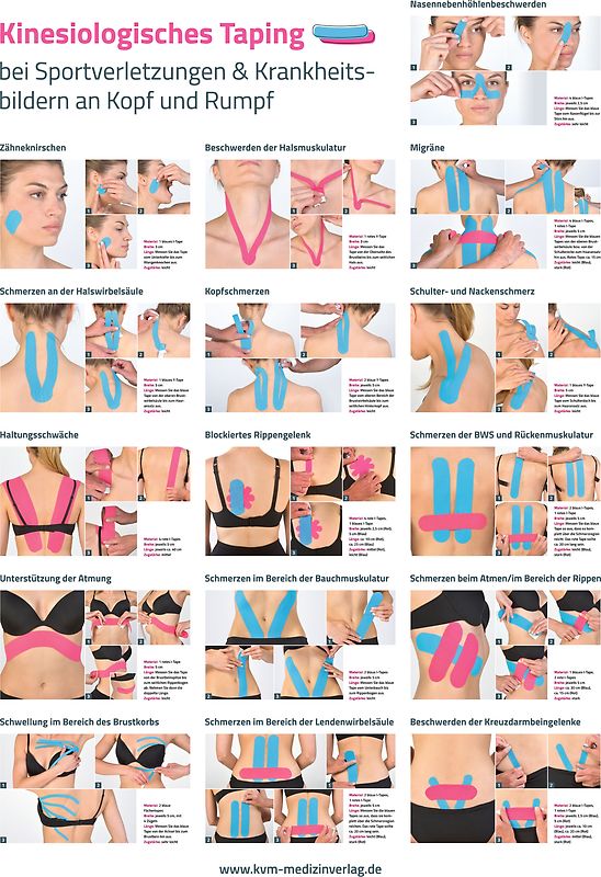 Poster Kinesiologisches Taping (3 Poster im Set)