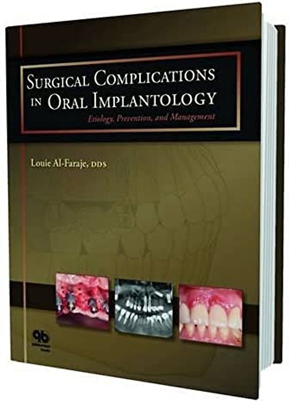 Surgical Complications in Oral Implantology: Etiology, Prevention, and Management