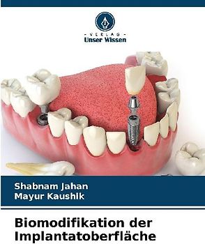 Biomodifikation der Implantatoberfläche