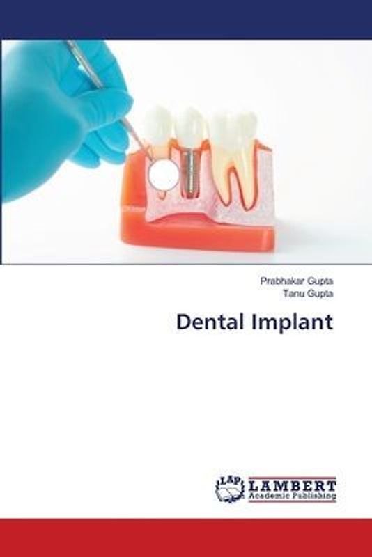 Dental Implant