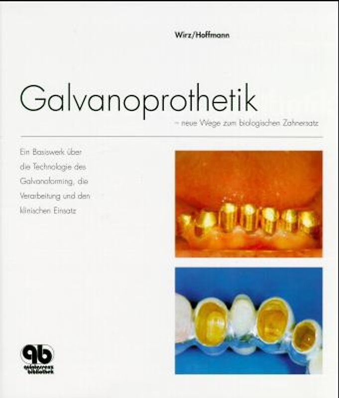Galvanoprothetik