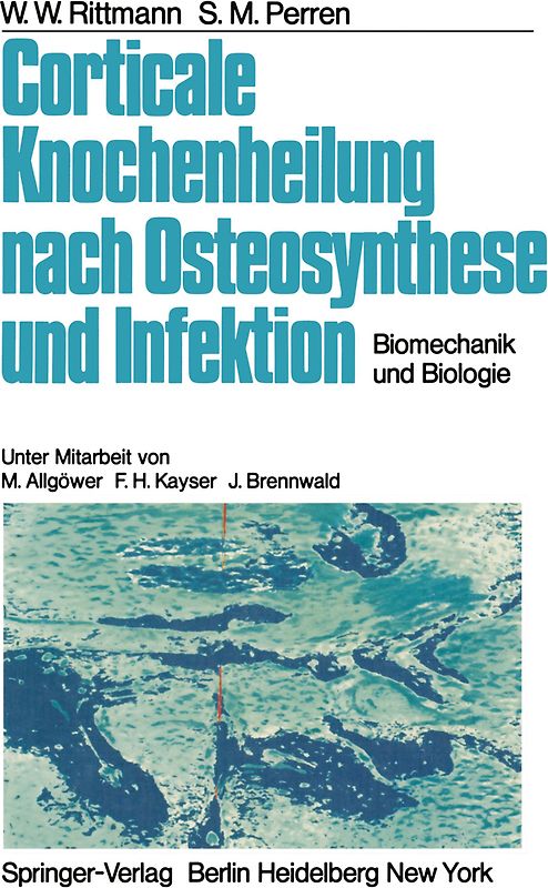 Corticale Knochenheilung nach Osteosynthese und Infektion