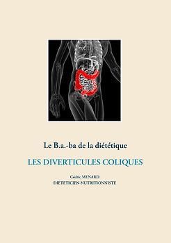 Le B.a.-Ba. diététique pour les diverticules coliques