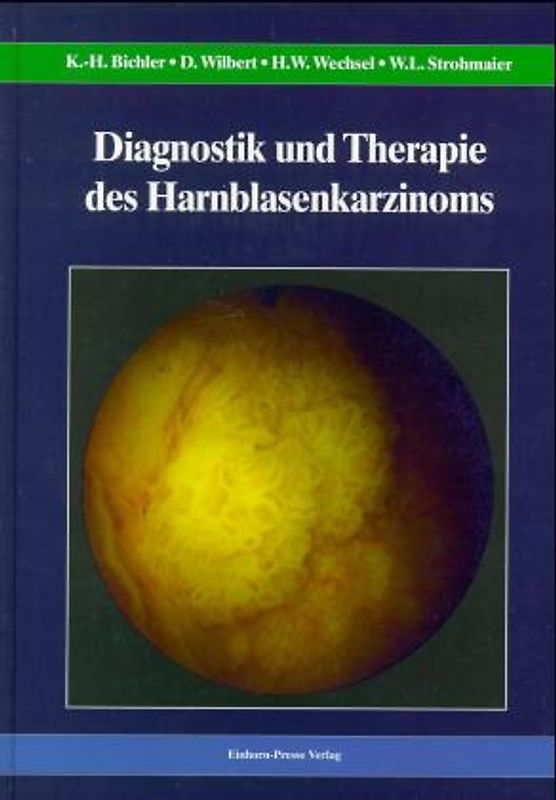 Diagnostik und Therapie des Harnblasenkarzinoms