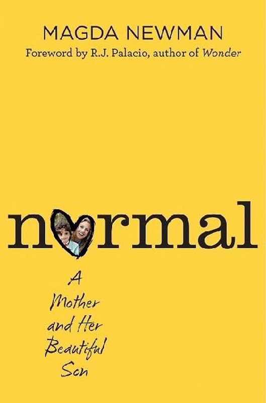 Normal