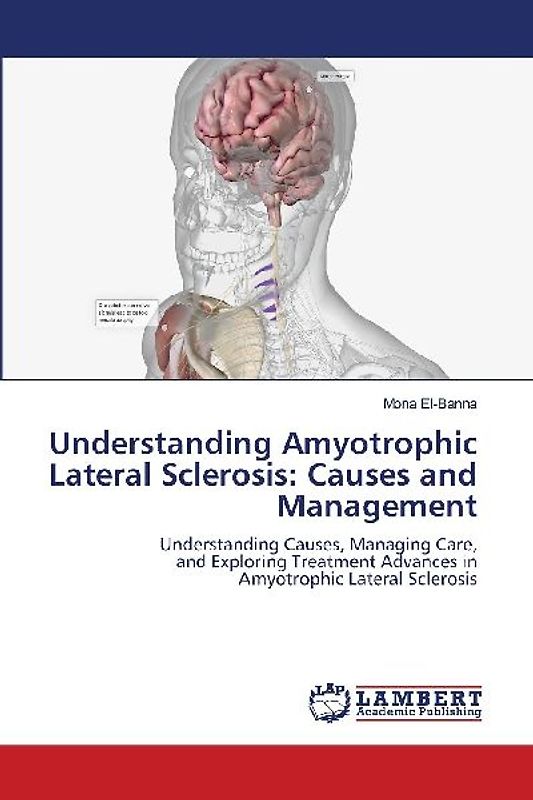Understanding Amyotrophic Lateral Sclerosis: Causes and Management