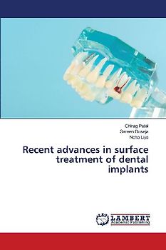 Recent advances in surface treatment of dental implants