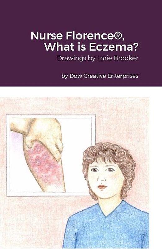 Nurse Florence®, What is Eczema?