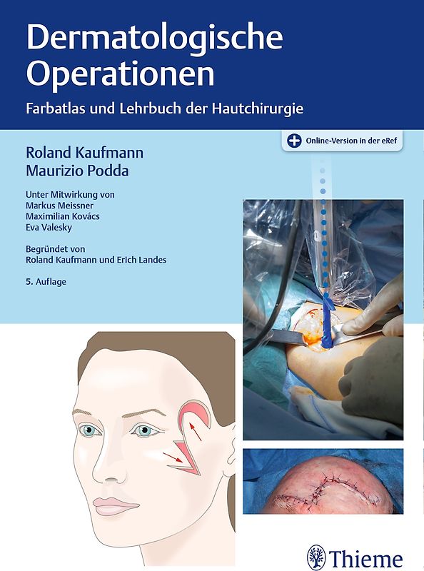 Dermatologische Operationen: Farbatlas und Lehrbuch der Hautchirurgie