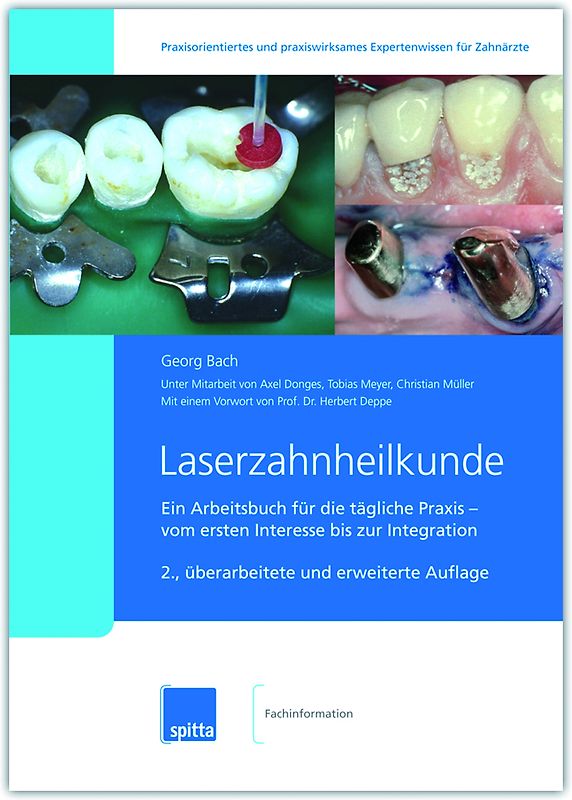 Laserzahnheilkunde