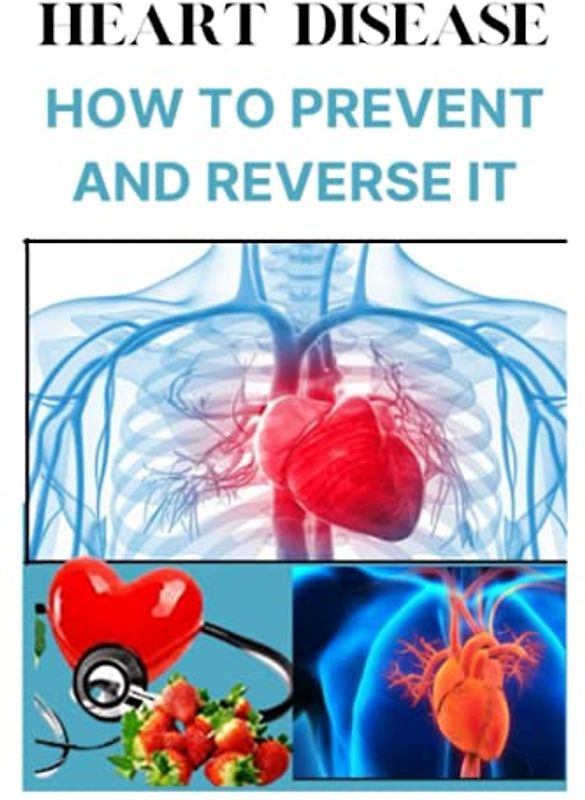 Heart Disease: How To Prevent And Reverse It: Treat Arterial Plaque And Prevent Heart Attacks And Strokes, Improve Cardiac Health And Lose Weight, ... causes, treatment and Remedies, Monitoring