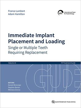 Immediate Implant Placement and Loading – Single or Multiple Teeth Requiring Replacement