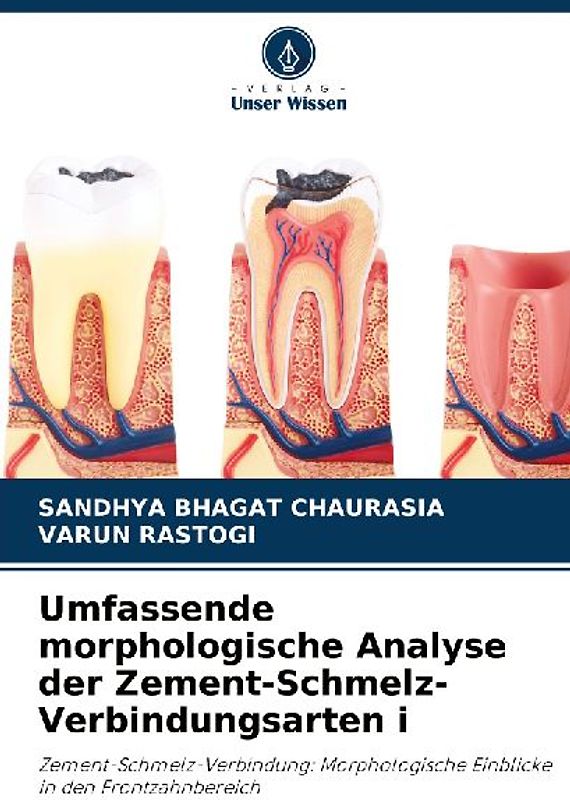 Umfassende morphologische Analyse der Zement-Schmelz-Verbindungsarten i