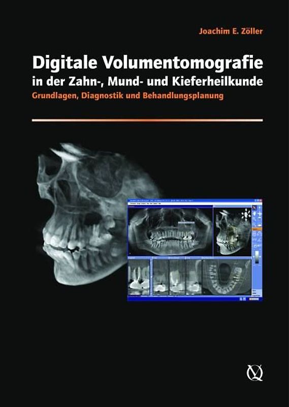 Digitale Volumentomografie in der Zahnmedizin