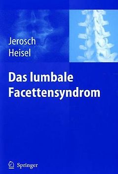 Das Facetten-Syndrom. Ursachen - Diagnostik - Therapie - Prophylaxe