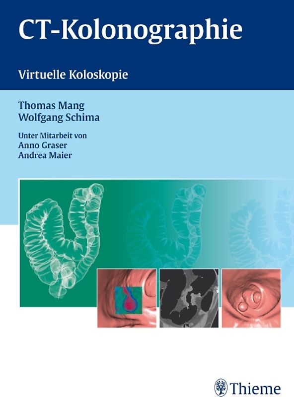 CT - Kolonographie