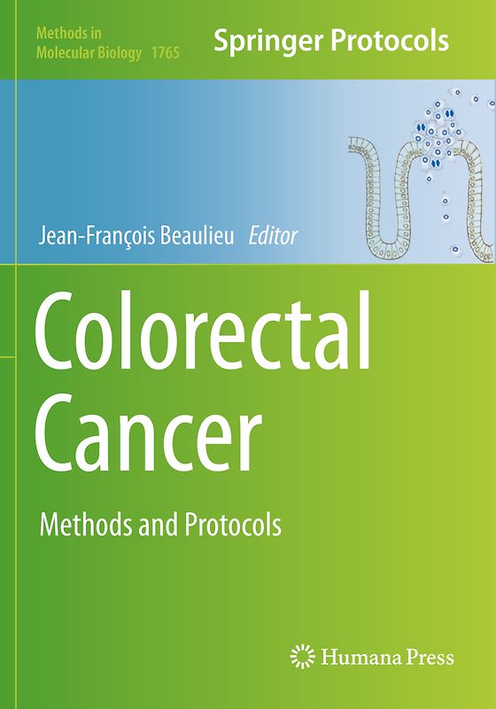 Colorectal Cancer