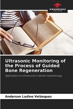 Ultrasonic Monitoring of the Process of Guided Bone Regeneration