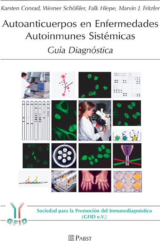 Autoanticuerpos en Enfermedades Autoinmunes Sistémicas