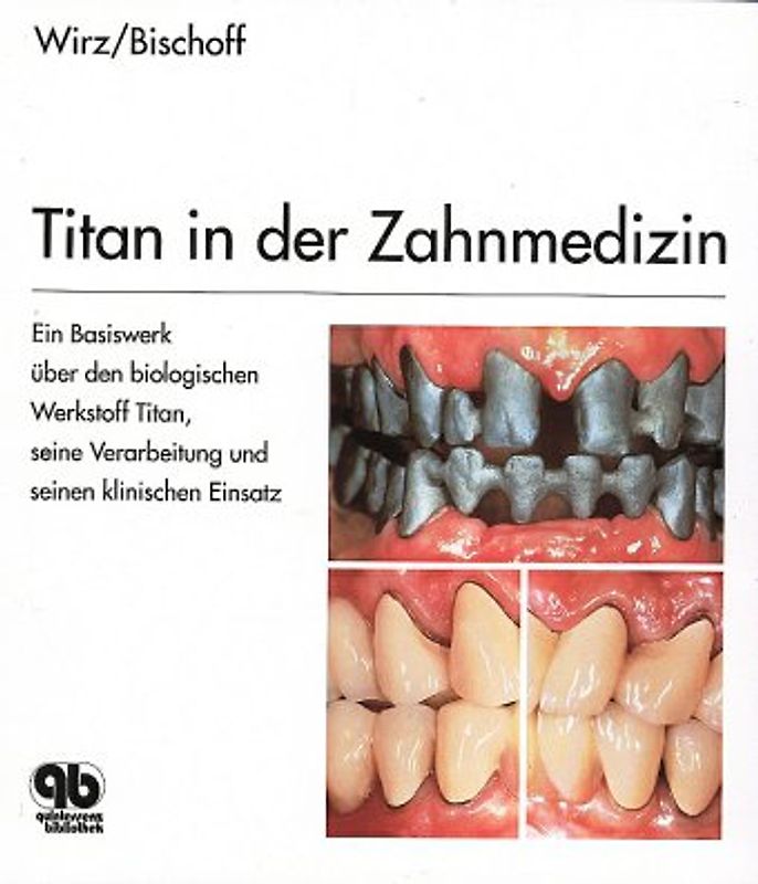 Titan in der Zahnmedizin