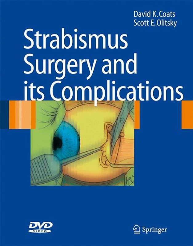 Strabismus Surgery and its Complications