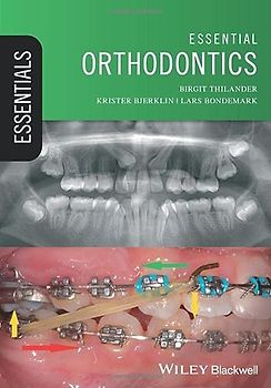 Essential Orthodontics