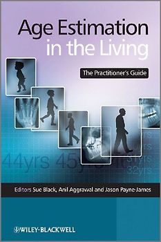 Age Estimation in the Living