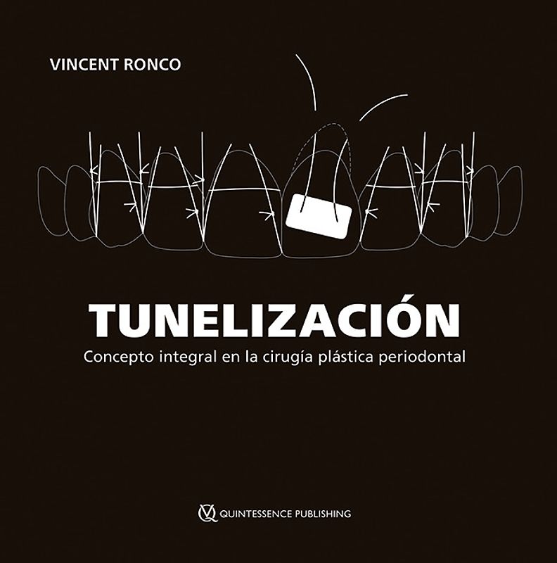 Tunelización