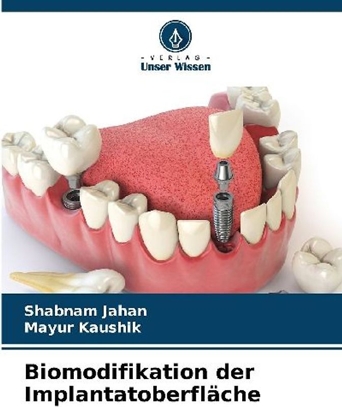 Biomodifikation der Implantatoberfläche