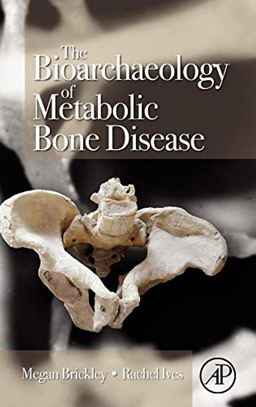 The Bioarchaeology of Metabolic Bone Disease