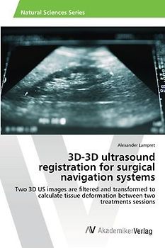 3D-3D ultrasound registration for surgical navigation systems