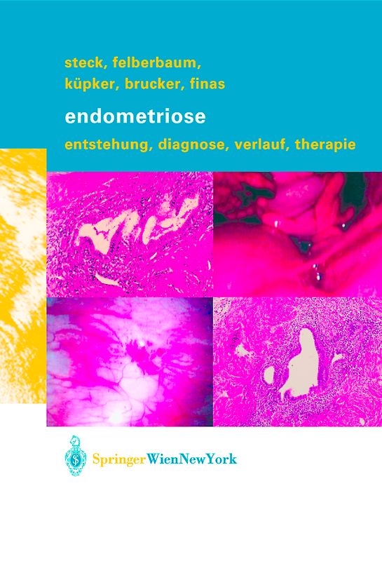 Endometriose