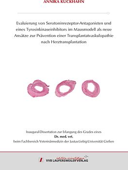Evaluierung von Serotoninrezeptor-Antagonisten und eines Tyrosinkinaseinhibitors im Mausmodell als neue Ansätze zur Prävention einer Transplantatvaskulopathie nach Herztransplantation