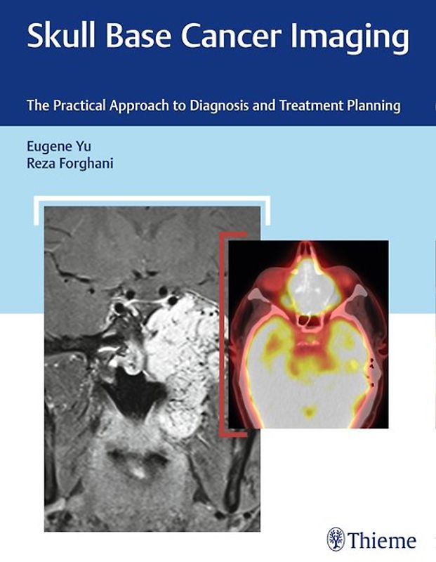 Skull Base Cancer Imaging