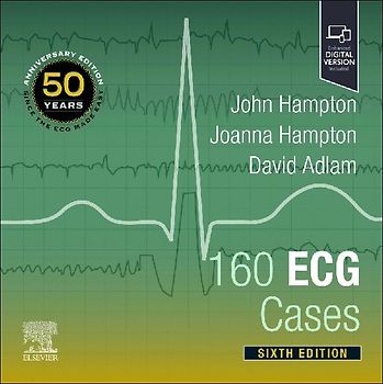 160 ECG Cases