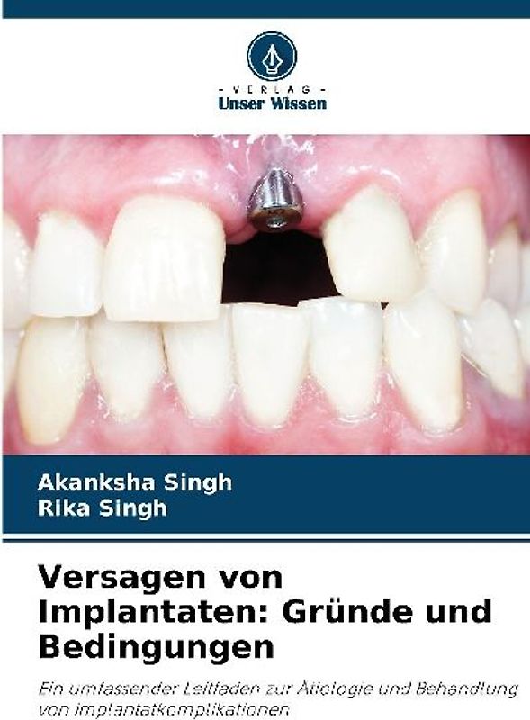Versagen von Implantaten: Gründe und Bedingungen