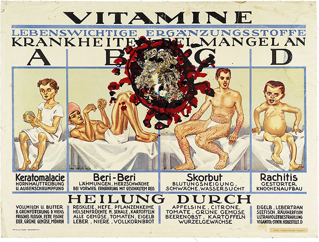 Befallerscheinungen/Veneral Diseases/Maladies Vénériennes