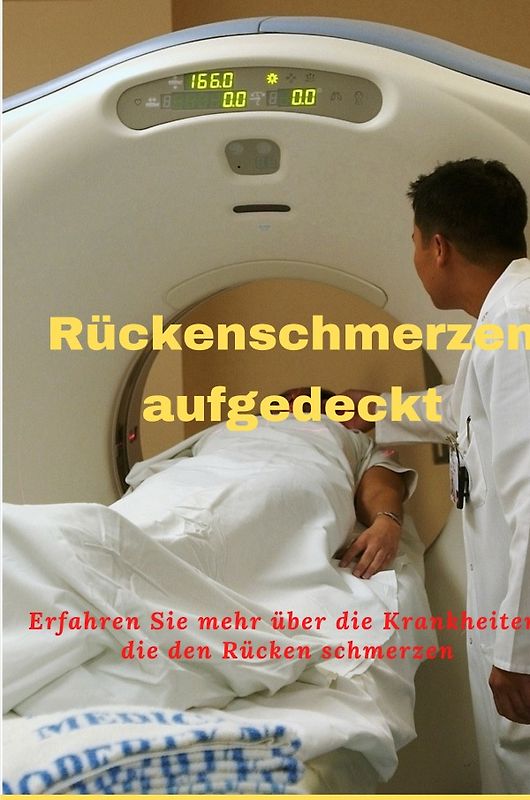 Rückenschmerzen aufgedeckt