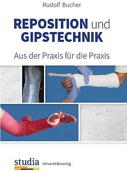 Reposition und Gipstechnik