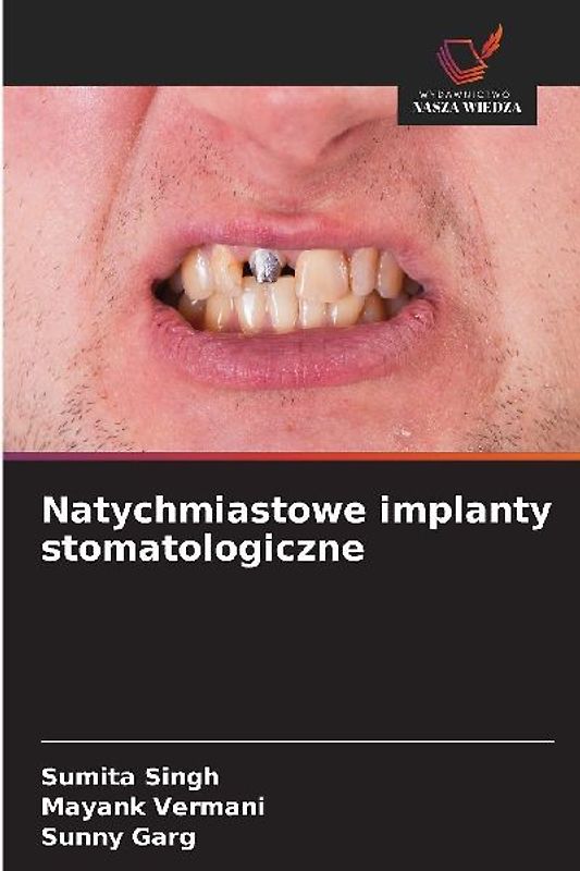 Natychmiastowe implanty stomatologiczne