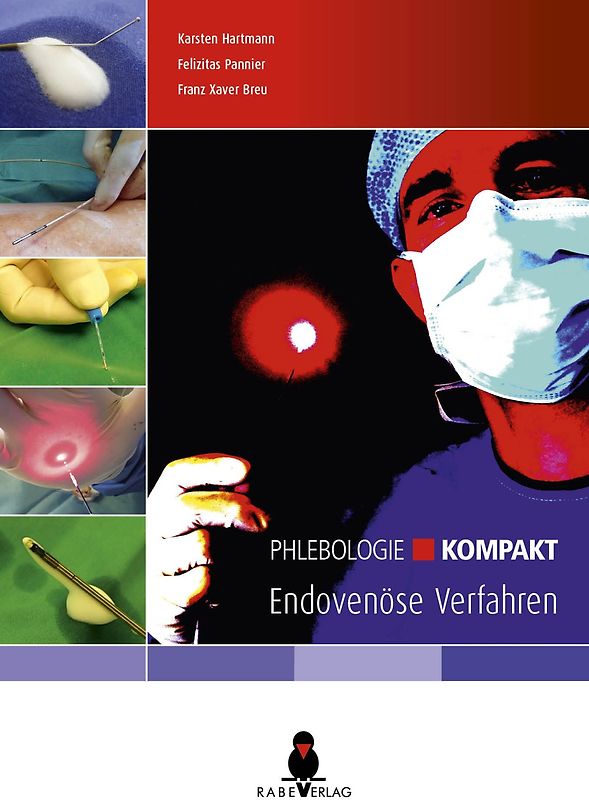 Phlebologie kompakt - Endovenöse Verfahren