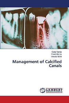Management of Calcified Canals