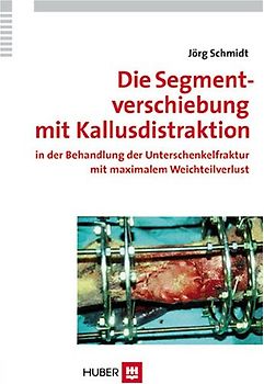 Die Segmentverschiebung mit Kallusdistraktion in der Behandlung der Unterschenkelfraktur mit maximalem Weichteilverlust