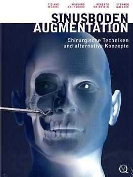 Sinusbodenaugmentation