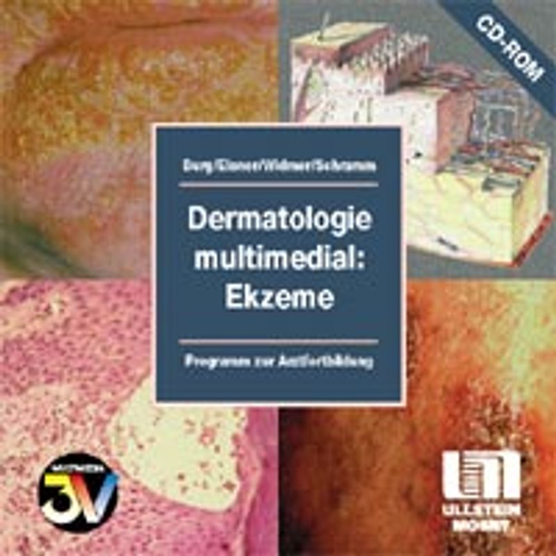 Dermatologie multimedial: Ekzeme. Programm zur Arztfortbildung